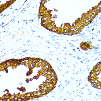 ACPP / PAP Antibody - Immunohistochemistry of paraffin-embedded human prostate.