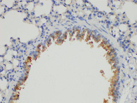 ACPP / PAP Antibody - Immunohistochemistry of paraffin-embedded Mouse lung using PSAP Ployclonal Antibody at dilution of 1:100.
