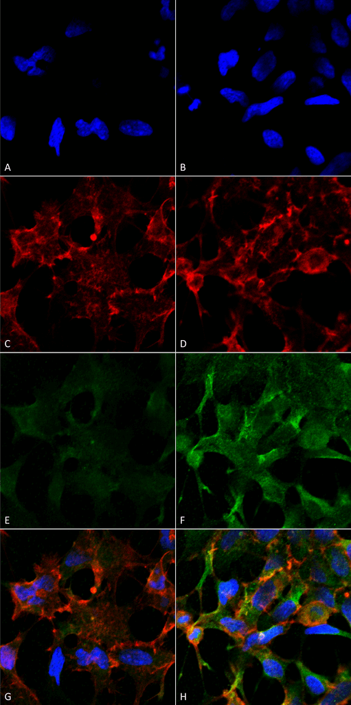 Acrolein Antibody - Immunocytochemistry/Immunofluorescence analysis using Mouse Anti-Acrolein Monoclonal Antibody, Clone 2H2. Tissue: Embryonic kidney epithelial cell line (HEK293). Species: Human. Fixation: 5% Formaldehyde for 5 min. Primary Antibody: Mouse Anti-Acrolein Monoclonal Antibody  at 1:50 for 30-60 min at RT. Secondary Antibody: Goat Anti-Mouse Alexa Fluor 488 at 1:1500 for 30-60 min at RT. Counterstain: Phalloidin Alexa Fluor 633 F-Actin stain; DAPI (blue) nuclear stain at 1:250, 1:50000 for 30-60 min at RT. Magnification: 20X (2X Zoom). (A,C,E,G) - Untreated. (B,D,F,H) - Cells cultured overnight with 50 µM H2O2. (A,B) DAPI (blue) nuclear stain. (C,D) Phalloidin Alexa Fluor 633 F-Actin stain. (E,F) Acrolein Antibody. (G,H) Composite. Courtesy of: Dr. Robert Burke, University of Victoria.