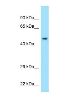Acrosin Antibody - ACR / Acrosin antibody Western blot of Fetal Lung lysate. Antibody concentration 1 ug/ml.  This image was taken for the unconjugated form of this product. Other forms have not been tested.