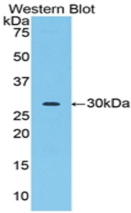 Acrosin Antibody - Western blot of recombinant Acrosin.  This image was taken for the unconjugated form of this product. Other forms have not been tested.