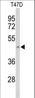 Acrosin Antibody - Western blot of ACR Antibody in T47D cell line lysates (35 ug/lane). ACR (arrow) was detected using the purified antibody.
