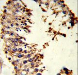 Acrosin Antibody - Formalin-fixed and paraffin-embedded human testis tissue reacted with ACR Antibody , which was peroxidase-conjugated to the secondary antibody, followed by DAB staining. This data demonstrates the use of this antibody for immunohistochemistry; clinical relevance has not been evaluated.