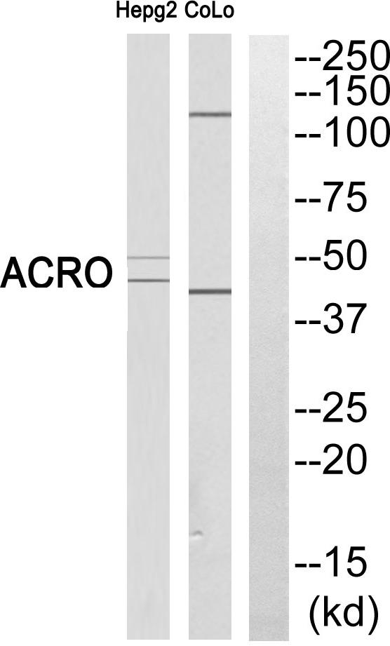 Acrosin Antibody - Western blot analysis of extracts from HEPG2 cells and COLO cells, using ACRO (heavy chain, Cleaved-Ile43) antibody.