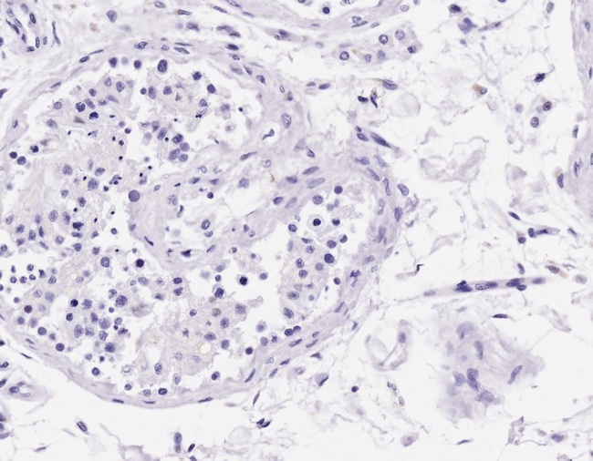 Acrosin Antibody - Antibody Negative Control showing staining of paraffin embedded Human Cerebellum, with no primary antibody.