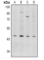 Acrosin Antibody - Western blot analysis of Acrosin expression in HepG2 (A), HEK293T (B), MCF7 (C), LO2 (D) whole cell lysates.
