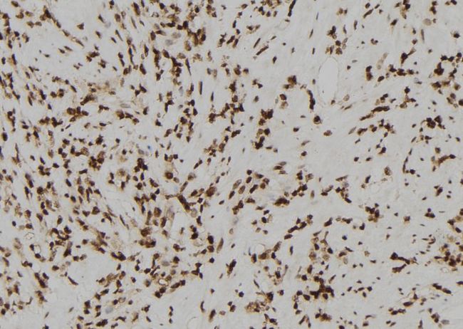 Acrosin Antibody - 1:100 staining human gastric tissue by IHC-P. The sample was formaldehyde fixed and a heat mediated antigen retrieval step in citrate buffer was performed. The sample was then blocked and incubated with the antibody for 1.5 hours at 22°C. An HRP conjugated goat anti-rabbit antibody was used as the secondary.
