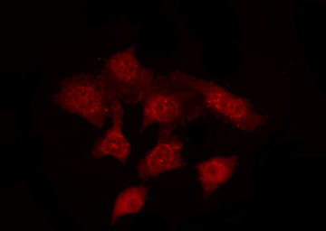 Acrosin Antibody - Staining HepG2 cells by IF/ICC. The samples were fixed with PFA and permeabilized in 0.1% Triton X-100, then blocked in 10% serum for 45 min at 25°C. The primary antibody was diluted at 1:200 and incubated with the sample for 1 hour at 37°C. An Alexa Fluor 594 conjugated goat anti-rabbit IgG (H+L) Ab, diluted at 1/600, was used as the secondary antibody.