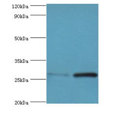 ACRV1/Intra-Acrosomal Protein Antibody - Western blot. All lanes: ACRV1 antibody at 4 ug/ml. Lane 1: mouse liver tissue. Lane 2: mouse gonad tissue. Secondary antibody: Goat polyclonal to rabbit at 1:10000 dilution. Predicted band size: 28 kDa. Observed band size: 28 kDa.