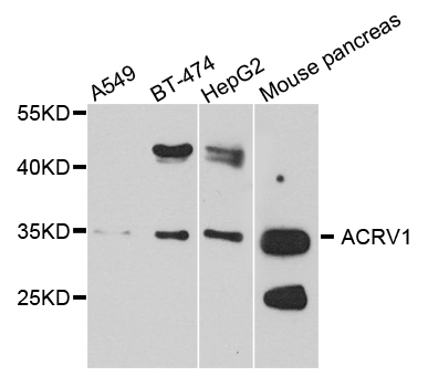 ACRV1/Intra-Acrosomal Protein Antibody - Western blot analysis of extract of various cells.