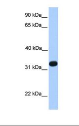 ACRV1/Intra-Acrosomal Protein Antibody - Fetal liver lysate. Antibody concentration: 1.0 ug/ml. Gel concentration: 12%.  This image was taken for the unconjugated form of this product. Other forms have not been tested.