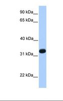 ACRV1/Intra-Acrosomal Protein Antibody - Fetal liver lysate. Antibody concentration: 1.0 ug/ml. Gel concentration: 12%.  This image was taken for the unconjugated form of this product. Other forms have not been tested.