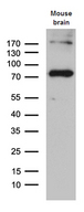 ACS5 / ACSL5 Antibody - Western blot analysis of extracts. (35ug) from mouse brain tissue lysate by using anti-ACSL5 monoclonal antibody. (1:500)