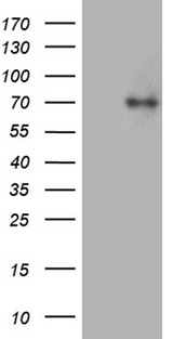 ACS5 / ACSL5 Antibody - HEK293T cells were transfected with the pCMV6-ENTRY control. (Left lane) or pCMV6-ENTRY ACSL5. (Right lane) cDNA for 48 hrs and lysed