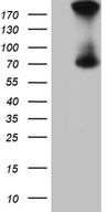 ACS5 / ACSL5 Antibody - HEK293T cells were transfected with the pCMV6-ENTRY control. (Left lane) or pCMV6-ENTRY ACSL5. (Right lane) cDNA for 48 hrs and lysed