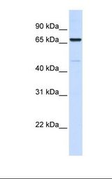ACS5 / ACSL5 Antibody - Placenta lysate. Antibody concentration: 1.0 ug/ml. Gel concentration: 12%.  This image was taken for the unconjugated form of this product. Other forms have not been tested.