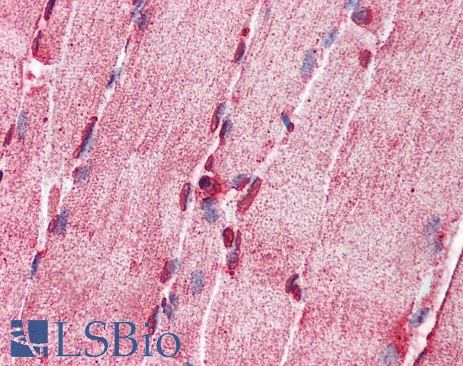 ACS5 / ACSL5 Antibody - Anti-ACSL5 antibody IHC of human skeletal muscle. Immunohistochemistry of formalin-fixed, paraffin-embedded tissue after heat-induced antigen retrieval. Antibody concentration 5 ug/ml.  This image was taken for the unconjugated form of this product. Other forms have not been tested.