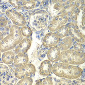 ACS5 / ACSL5 Antibody - Immunohistochemistry of paraffin-embedded rat kidney using ACSL5 antibodyat dilution of 1:100 (40x lens).