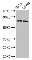 ACS5 / ACSL5 Antibody - Western Blot Positive WB detected in: Hela whole cell lysate, Rat liver tissue All lanes: ACSL5 antibody at 3µg/ml Secondary Goat polyclonal to rabbit IgG at 1/50000 dilution Predicted band size: 76 kDa Observed band size: 76 kDa