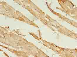 ACS5 / ACSL5 Antibody - Immunohistochemistry of paraffin-embedded human skeletal muscle tissue using antibody at dilution of 1:100.