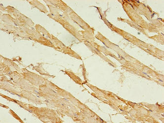 ACS5 / ACSL5 Antibody - Immunohistochemistry of paraffin-embedded human skeletal muscle tissue using ACSL5 Antibody at dilution of 1:100