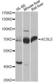 ACS5 / ACSL5 Antibody - Western blot analysis of extracts of various cell lines, using ACSL5 antibody at 1:1000 dilution. The secondary antibody used was an HRP Goat Anti-Rabbit IgG (H+L) at 1:10000 dilution. Lysates were loaded 25ug per lane and 3% nonfat dry milk in TBST was used for blocking. An ECL Kit was used for detection and the exposure time was 1s.