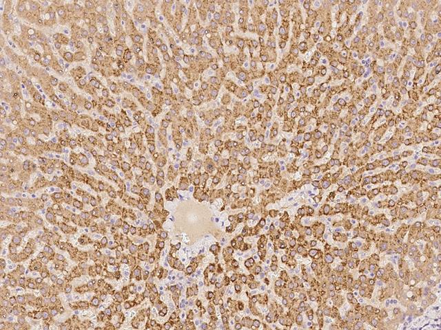 ACS5 / ACSL5 Antibody - Immunochemical staining of human ACSL5 in human liver with rabbit polyclonal antibody at 1:100 dilution, formalin-fixed paraffin embedded sections.