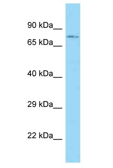 ACSBG1 / hsBG Antibody - ACSBG1 / hsBG antibody Western Blot of HT1080. Antibody dilution: 1 ug/ml.  This image was taken for the unconjugated form of this product. Other forms have not been tested.