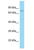 ACSBG1 / hsBG Antibody - ACSBG1 / hsBG antibody Western Blot of HT1080. Antibody dilution: 1 ug/ml.  This image was taken for the unconjugated form of this product. Other forms have not been tested.