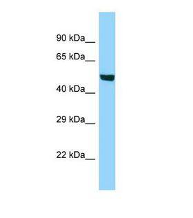 ACSBG1 / hsBG Antibody - Western blot of Human HT1080. ACSBG1 antibody dilution 1.0 ug/ml.  This image was taken for the unconjugated form of this product. Other forms have not been tested.
