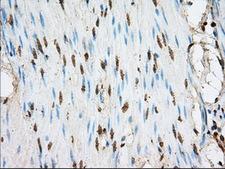 ACSBG1 / hsBG Antibody - IHC of paraffin-embedded colon tissue using anti-ACSBG1 mouse monoclonal antibody. (Dilution 1:50).