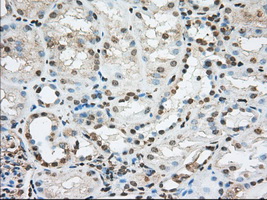 ACSBG1 / hsBG Antibody - IHC of paraffin-embedded Kidney tissue using anti-ACSBG1 mouse monoclonal antibody. (Dilution 1:50).
