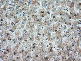 ACSBG1 / hsBG Antibody - IHC of paraffin-embedded liver tissue using anti-ACSBG1 mouse monoclonal antibody. (Dilution 1:50).