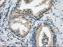 ACSBG1 / hsBG Antibody - IHC of paraffin-embedded prostate tissue using anti-ACSBG1 mouse monoclonal antibody. (Dilution 1:50).