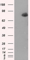 ACSBG1 / hsBG Antibody - HEK293T cells were transfected with the pCMV6-ENTRY control (Left lane) or pCMV6-ENTRY ACSBG1 (Right lane) cDNA for 48 hrs and lysed. Equivalent amounts of cell lysates (5 ug per lane) were separated by SDS-PAGE and immunoblotted with anti-ACSBG1.