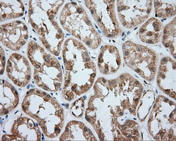 ACSBG1 / hsBG Antibody - Immunohistochemical staining of paraffin-embedded Human Kidney tissue using anti-ACSBG1 mouse monoclonal antibody.