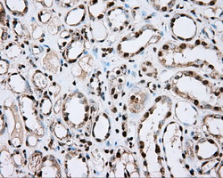 ACSBG1 / hsBG Antibody - IHC of paraffin-embedded Kidney tissue using anti-ACSBG1 mouse monoclonal antibody. (Dilution 1:50).