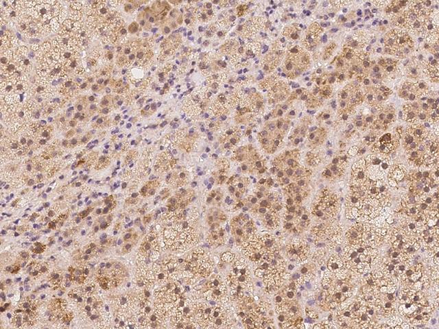 ACSBG1 / hsBG Antibody - Immunochemical staining of human ACSBG1 in human adrenal gland with rabbit polyclonal antibody at 1:100 dilution, formalin-fixed paraffin embedded sections.