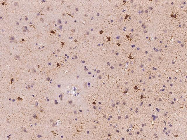 ACSBG1 / hsBG Antibody - Immunochemical staining of human ACSBG1 in human brain with rabbit polyclonal antibody at 1:100 dilution, formalin-fixed paraffin embedded sections.