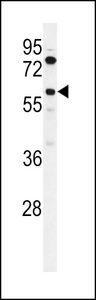 ACSBG2 Antibody - Western blot of ACBG2 Antibody in K562 cell line lysates (35 ug/lane). ACBG2 (arrow) was detected using the purified antibody.