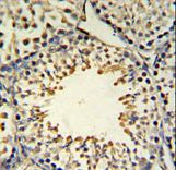 ACSBG2 Antibody - ACBG2 Antibody IHC of formalin-fixed and paraffin-embedded mouse testis tissue followed by peroxidase-conjugated secondary antibody and DAB staining.