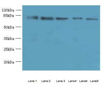 ACSBG2 Antibody - Western blot. All lanes: ACSBG2 antibody at 5 ug/ml. Lane 1: HeLa whole cell lysate. Lane 2: K562 whole cell lysate. Lane 3: A549 whole cell lysate. Lane 4: Human high value serum. Lane 5: A431 whole cell lysate. Secondary Goat polyclonal to Rabbit IgG at 1:10000 dilution. Predicted band size: 74 kDa. Observed band size: 74 kDa.