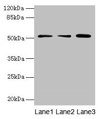 ACSBG2 Antibody - Western blot All lanes: ACSBG2 antibody at 5µg/ml Lane 1: Hela whole cell lysate Lane 2: K562 whole cell lysate Lane 3: A549 whole cell lysate Lane 4: Human high value serumLane 5: A431 whole cell lysate Secondary Goat polyclonal to rabbit IgG at 1/10000 dilution Predicted band size: 75, 69, 54, 52 kDa Observed band size: 75 kDa