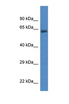 ACSF2 Antibody - ACSF2 antibody Western blot of Fetal Lung lysate. Antibody concentration 1 ug/ml.  This image was taken for the unconjugated form of this product. Other forms have not been tested.