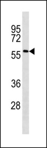 ACSF2 Antibody - ACSF2 Antibody western blot of Jurkat cell line lysates (35 ug/lane). The ACSF2 antibody detected the ACSF2 protein (arrow).