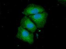 ACSF2 Antibody - ICC/IF analysis of ACSF2 in HeLa cells line, stained with DAPI (Blue) for nucleus staining and monoclonal anti-human ACSF2 antibody (1:100) with goat anti-mouse IgG-Alexa fluor 488 conjugate (Green).