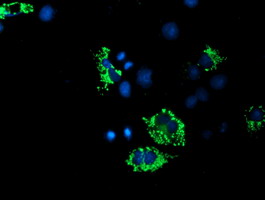 ACSF2 Antibody - Anti-ACSF2 mouse monoclonal antibody immunofluorescent staining of COS7 cells transiently transfected by pCMV6-ENTRY ACSF2.