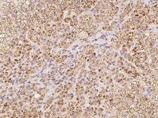 ACSF2 Antibody - Immunochemical staining of human ACSF2 in human adrenal gland with rabbit polyclonal antibody at 1:100 dilution, formalin-fixed paraffin embedded sections.