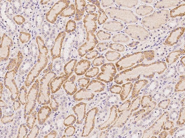 ACSF2 Antibody - Immunochemical staining of human ACSF2 in human kidney with rabbit polyclonal antibody at 1:100 dilution, formalin-fixed paraffin embedded sections.