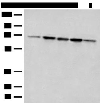 ACSF2 Antibody - Western blot analysis of 293T cell Rat liver tissue A172 and Jurkat cell lysates  using ACSF2 Polyclonal Antibody at dilution of 1:400